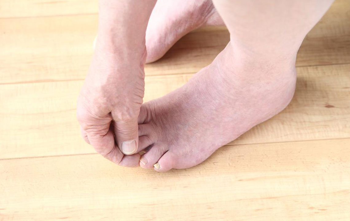 Fibromyalgia Foot Pain – Factors to Understand